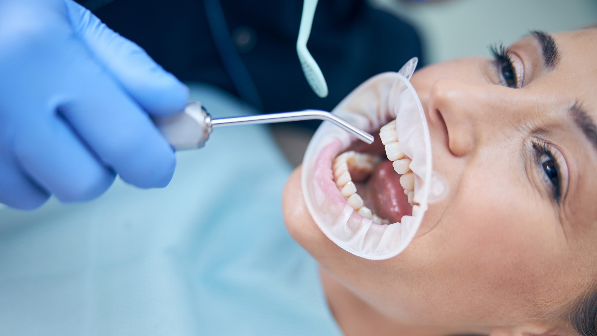 young-woman-having-teeth-treated-in-clinic-2024-10-21-04-14-06-utc