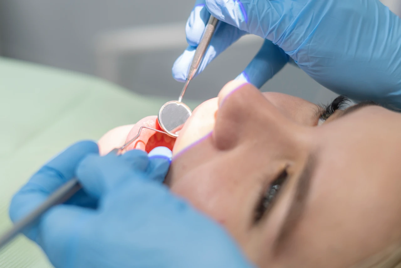 gum disease1